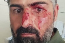 ضرب و شتم محیط‌بان سابق صحنه ای توسط شکارچیان غیرمجاز