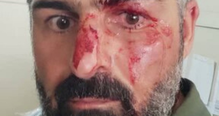 ضرب و شتم محیط‌بان سابق صحنه ای توسط شکارچیان غیرمجاز