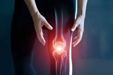 هر آنچه که باید درباره بیماری آرتروز باید بدانید!