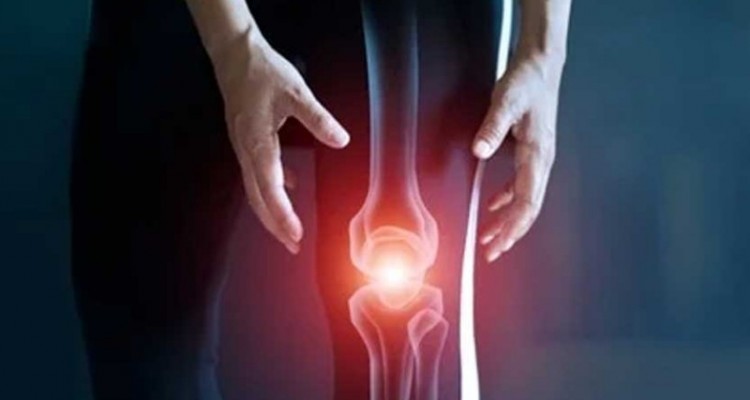 هر آنچه که باید درباره بیماری آرتروز باید بدانید!