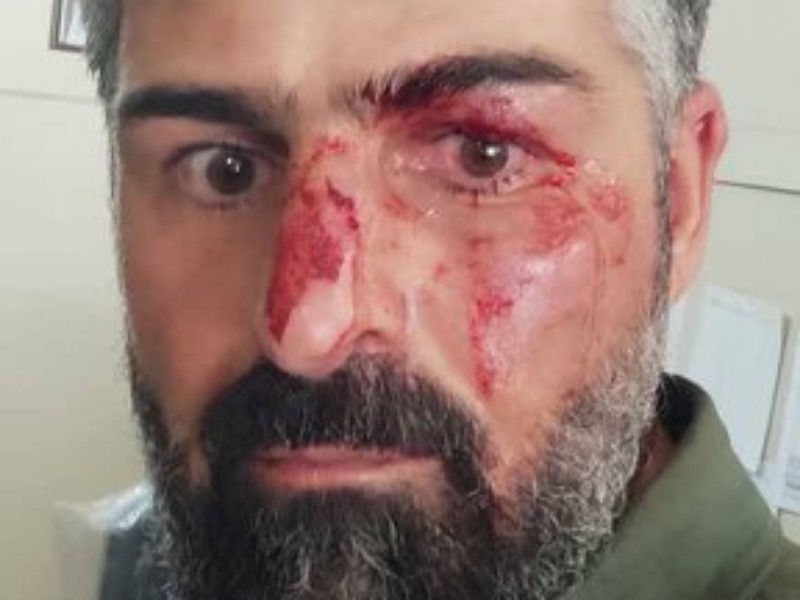 ضرب و شتم محیط‌بان سابق صحنه ای توسط شکارچیان غیرمجاز